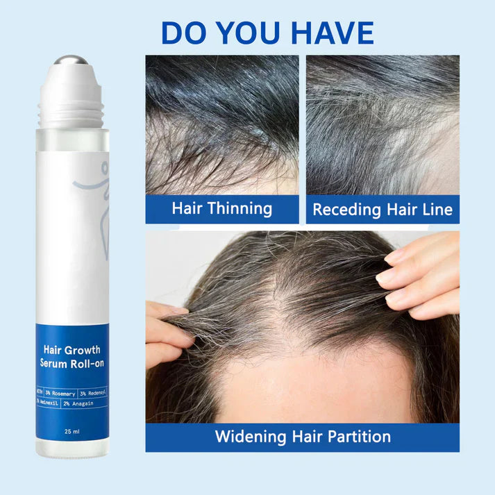 Hair Growth Roll-On See hair growth in 4 weeks